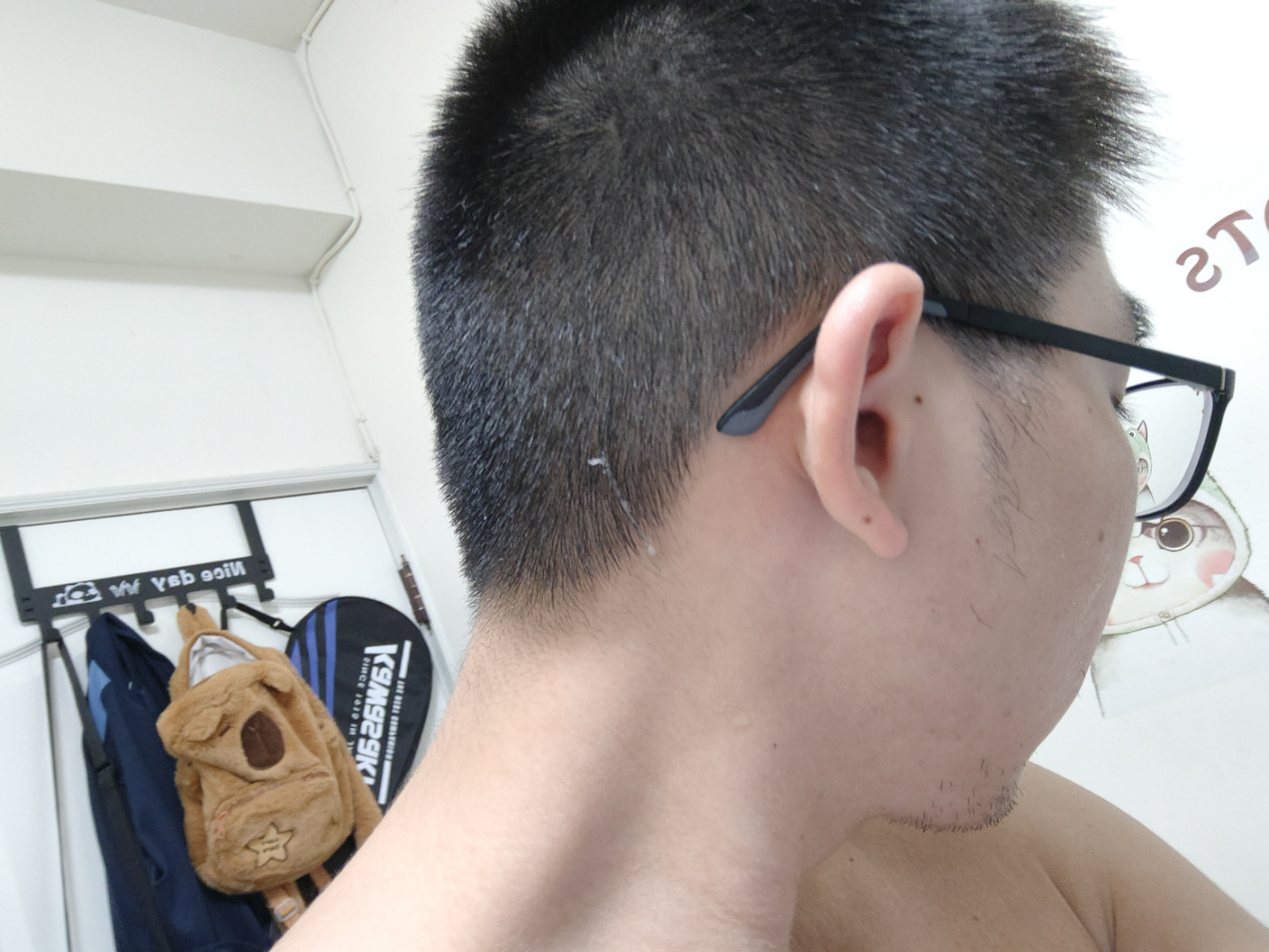 噴到頭上了