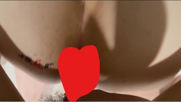肛交短片