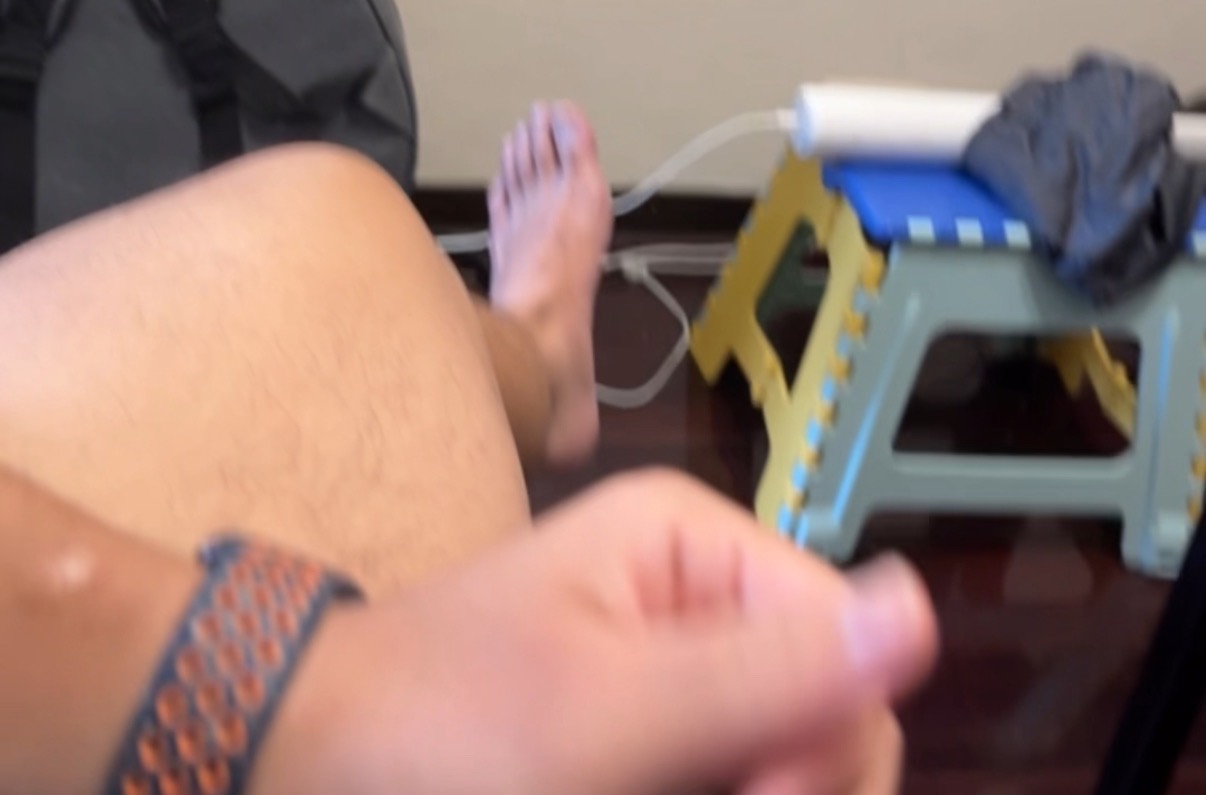 我小時候以為這個形狀是骨折